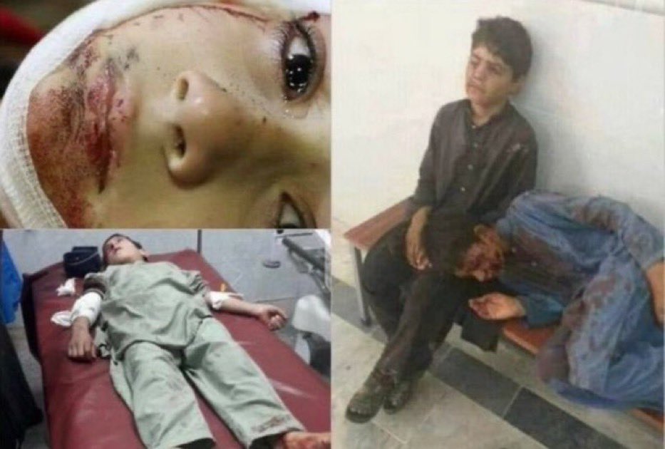 India commiting #warcrimes! Where is <a href="/hrw/">Human Rights Watch</a> ????? Where are #HUMANRIGHTS? It MUST BE WORKING FOR THE WHOLE WORLD! Not only for the ones YOU DECIDE! <a href="/UNICEF/">UNICEF</a>
#PrayForPakistan #KashmirIsPakistan
#KashmirIsBleeding #AzerbaijanStandWithPakistan