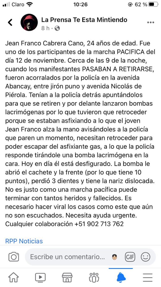 migueelmarca's tweet photo. ¡POR FAVOR DIFUNDIR! 🙏🏻
Es mi amigo del colegio y hoy necesita apoyo. Comuníquese al número en imagen que cada sol ayudaría mucho, la policía lo atacó y las manos se lavó. 

➡️ 9️⃣0️⃣2️⃣-7️⃣1️⃣3️⃣- 7️⃣6️⃣2️⃣
➡️ 902713762 
#RenuciaMerino #MerinoNoMeRepresenta #MerinoNoNosRepresenta https://t.co/rD9O8ugmLW