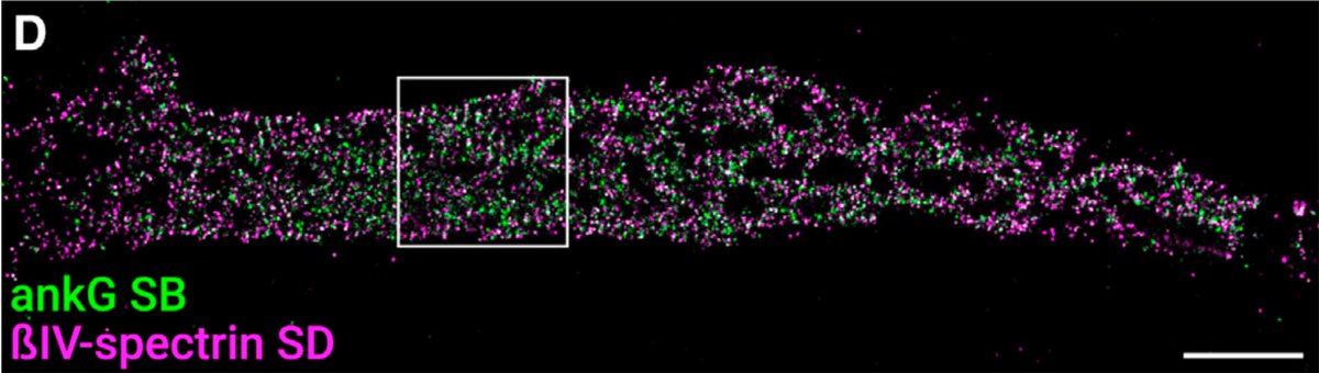 The AIS has a really beautiful structure — seriously, just look at the organization of ankyrin in this STORM image