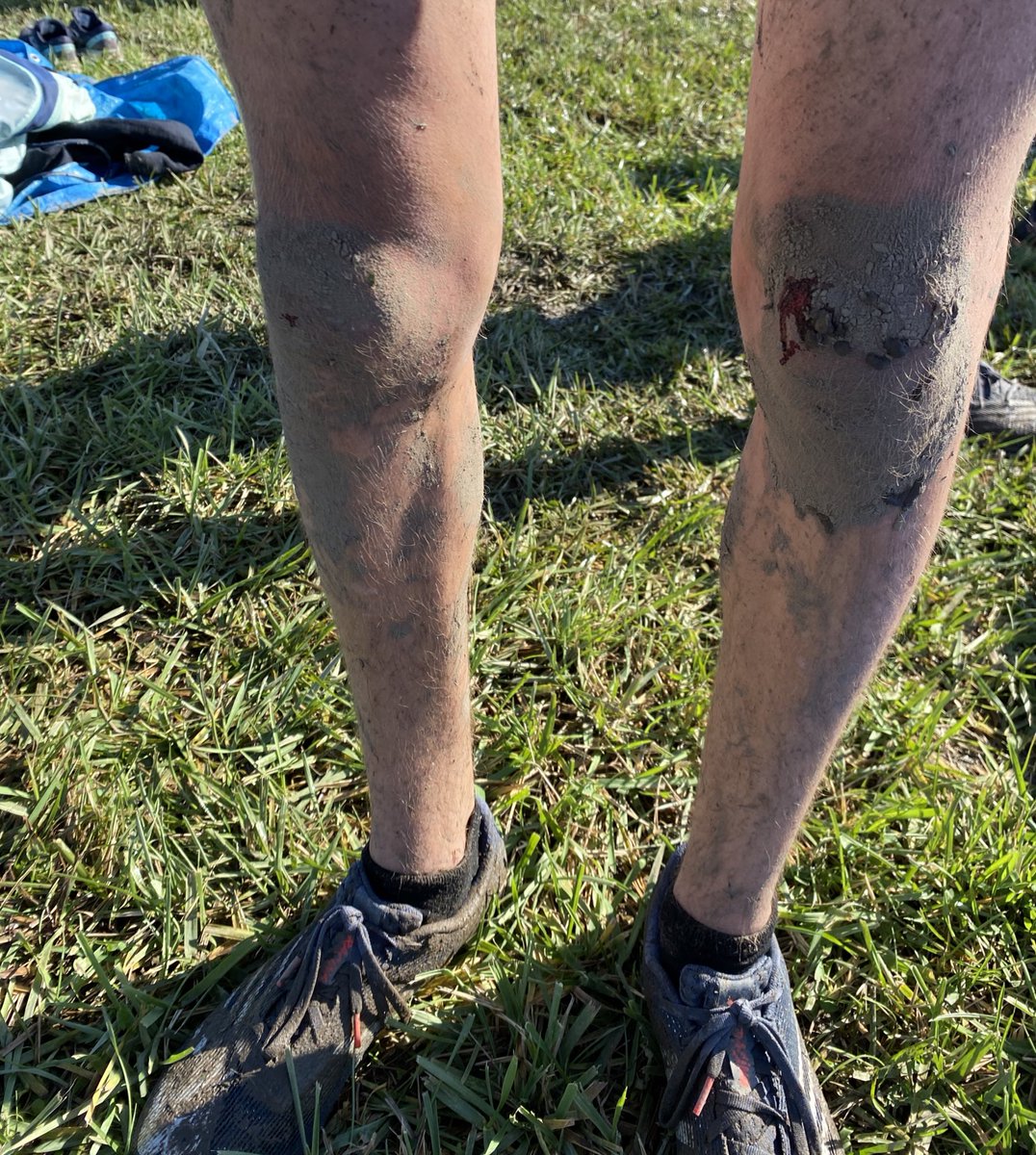T.R.E. Boys XC/TF (@treboysxctf) on Twitter photo If this picture from today’s Sectional doesn’t scream cross country racing, I don’t know what does! Mud, blood and soaked spikes! Let’s go Jake!! <a href="/KellyJsr5k/">kelly raimonde</a> <a href="/njmilesplit/">MileSplit New Jersey</a> <a href="/HSERaiderNation/">Raider Nation</a> If this picture from today’s Sectional doesn’t scream cross country racing, I don’t know what does! Mud, blood and soaked spikes! Let’s go Jake!! <a href="/KellyJsr5k/">kelly raimonde</a> <a href="/njmilesplit/">MileSplit New Jersey</a> <a href="/HSERaiderNation/">Raider Nation</a>