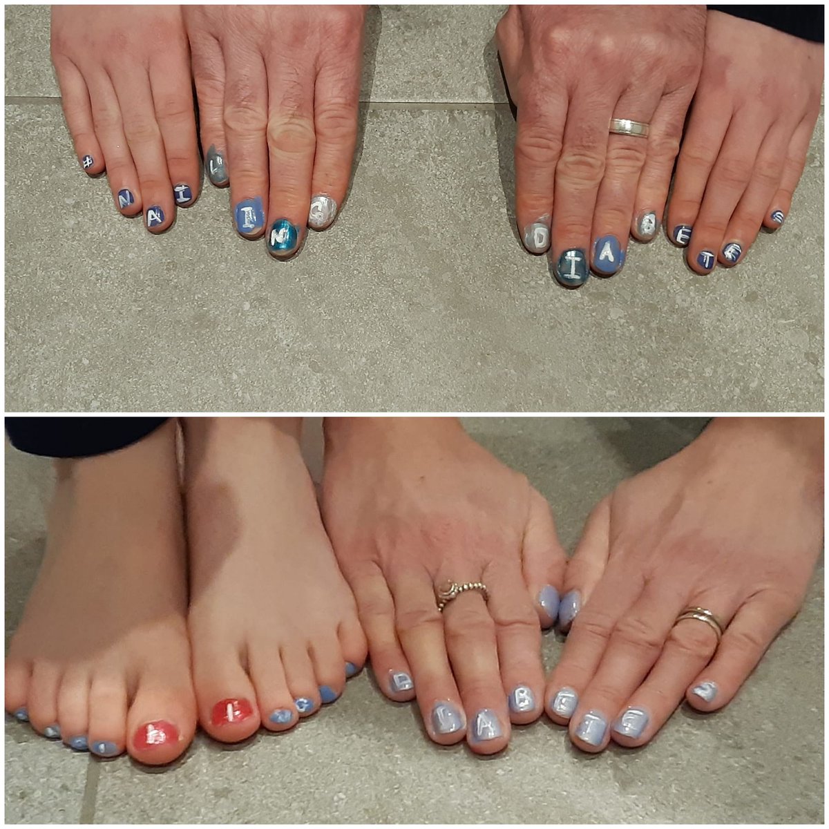 tomnelson85's tweet photo. @willcarling @DiabetesUK Thanks for helping raise awareness. My 11y/o daughter has now had T1 half her life. Here's our family attempts and donation text in #NailingDiabetes https://t.co/U4001Dih3m