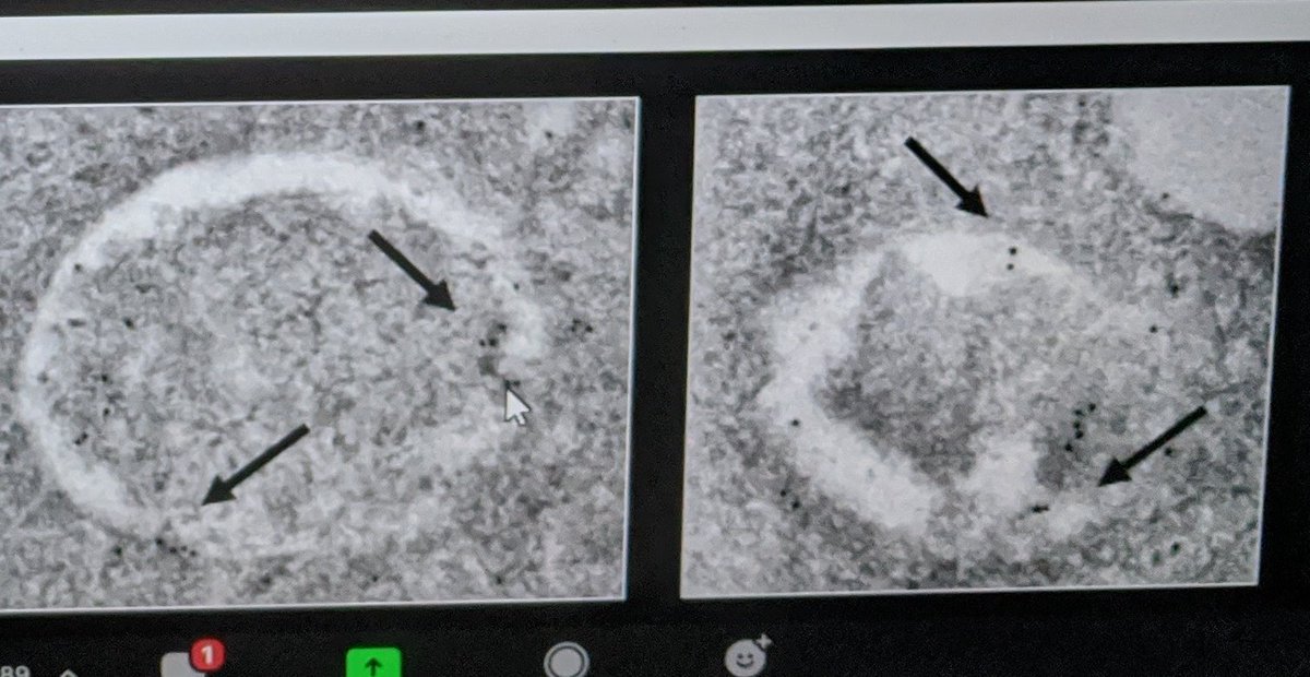 gritocosmico's tweet photo. Really nice talk of Eduardo Berenguer from @PTestillano group about PCD and autophagy during Brassica napus microspore embryogenesis, with cool ATG8 immunolocalization in TEM images! https://t.co/gu2RJeKxMz