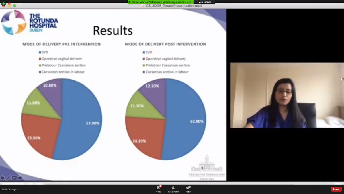 JOGSIreland's tweet photo. Sumaira Tariq's quick overview of her work on implementation of GBS PCR screening prior to induction of labour at @RotundaHospital #tops20JOGSposter #JOGS2020 https://t.co/Kbx3wSNYwg