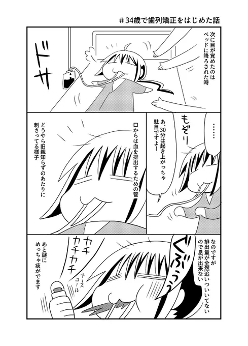 34歳で歯列矯正をはじめた話、その5入院編。漫画なのでラクそうに見えてしまってますが、腫れた後は滅茶苦茶痛いししんどいし、2度とやりたくないと言うのが正直な所ですw 実際1年後のボルト抜く手術を断ったダメ人間なので、ボルトと共に生きます…。 #入院 #歯科矯正 #顎変形症 #全身麻酔 