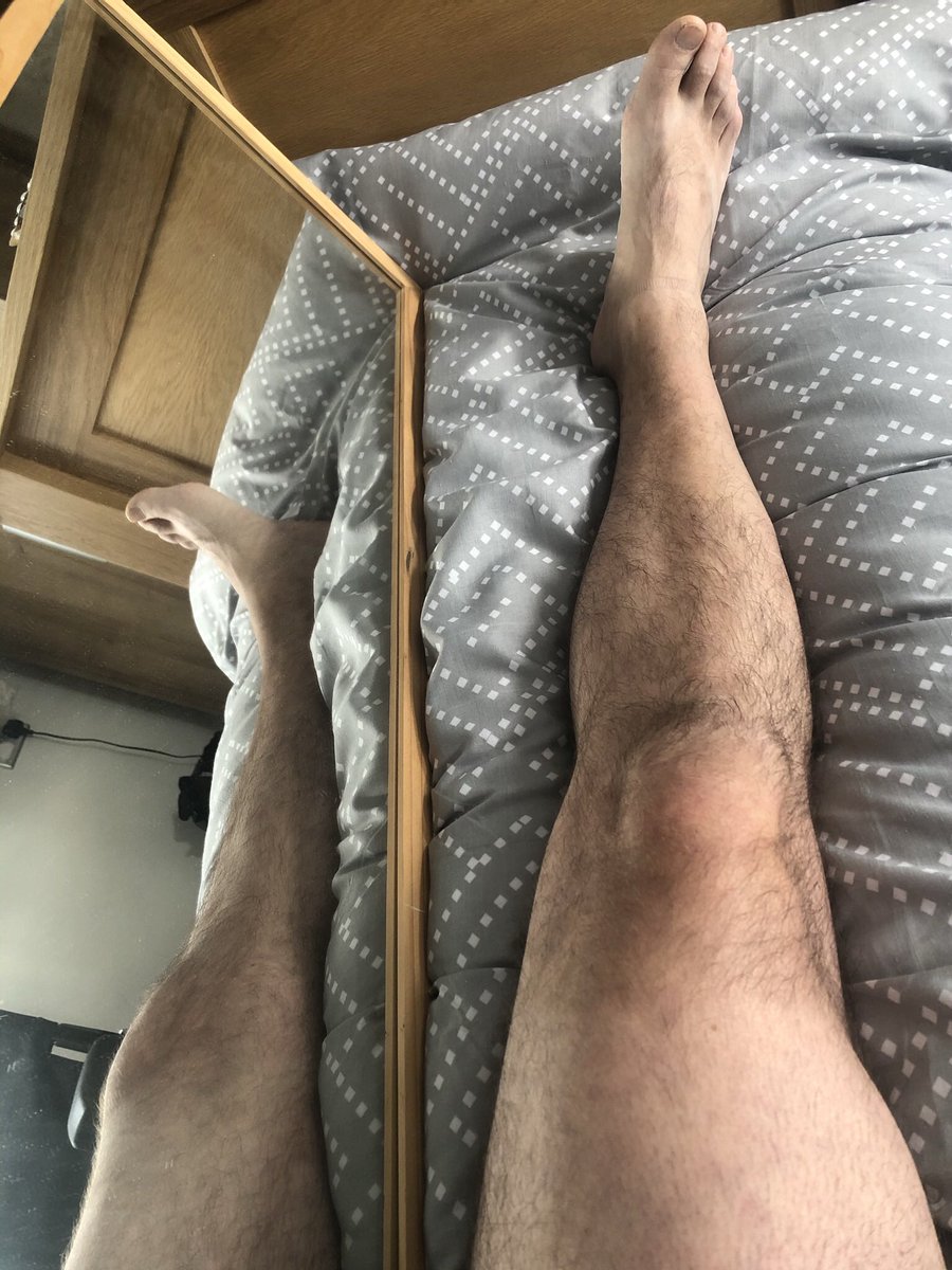 frombullets2biz's tweet photo. #mirrortherapy to get rid of #phantompains works really well but, so does talking to my stump and telling it my leg has gone and is not coming back #amputeelife https://t.co/5mlXImWOYr