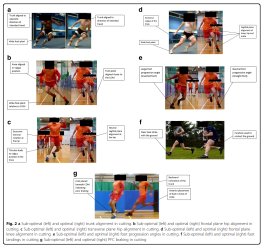 sciofmultispeed's tweet image. A technical framework to reduce knee joint loading during cutting 👇
Who knows, maybe some of these suggested postures may be conducive to faster cutting performance as well? 🏃‍♂️

@ThomasDonelon @TomDosSantos91 @PaulAJonesUoS 

sportsmedicine-open.springeropen.com/articles/10.11…