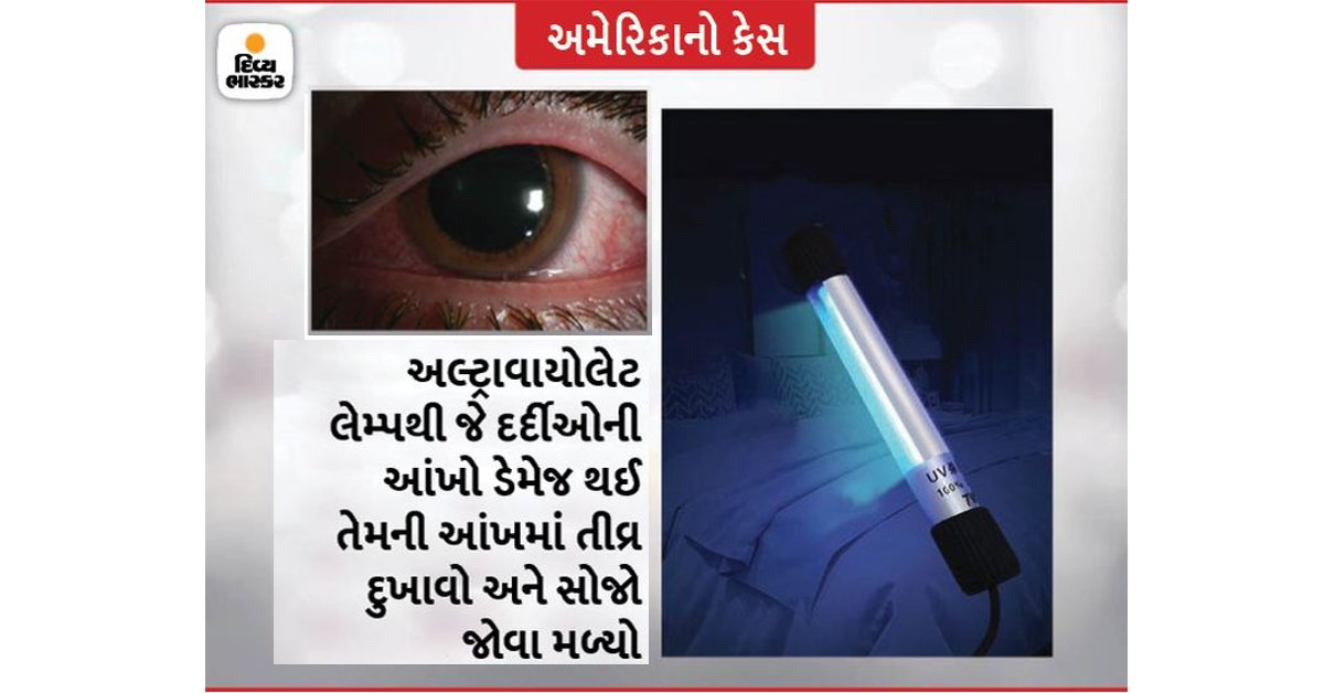 Divya_Bhaskar's tweet photo. ��લર્ટ : અમેરિકામાં અલ્ટ્રાવાયોલેટ લેમ્પથી ઘર-ઓફિસને સેનિટાઈઝ કરવામાં 7લોકોની આંખો ડેમેજ થઈ, જાણો તેના ઉપયોગની યોગ્ય રીત
https://t.co/dXp6jvb5dA

#UltravioletLamp #Eyes #Sanitizer https://t.co/7S0FB3YFR6