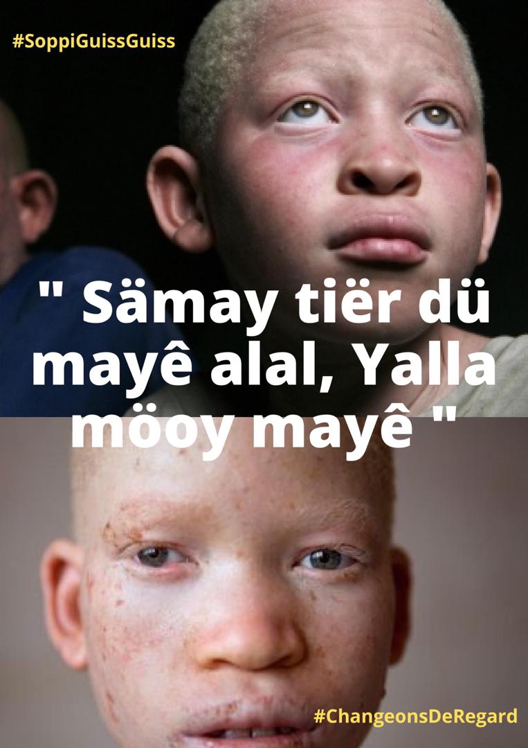 DiorfallGueye2's tweet photo. #SoppiGuissGuiss #ChangeonsDeRegard #Handicap #Fsaph #IBP #senegal #kebetu #Läago #Policy #spark
JJ-6 https://t.co/p09CNZ1TV4