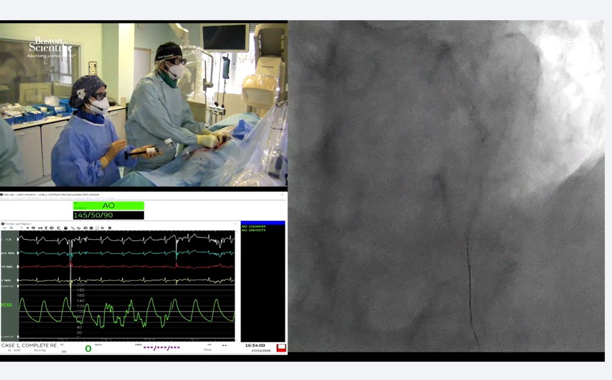 radcliffeCARDIO's tweet image. Are you watching these live cases in Complex PCI?
Login free now to watch - bit.ly/3fAEI8G

#CompleteRevasc @BSC_EU_Heart 
#MedEd #cardiotwitter