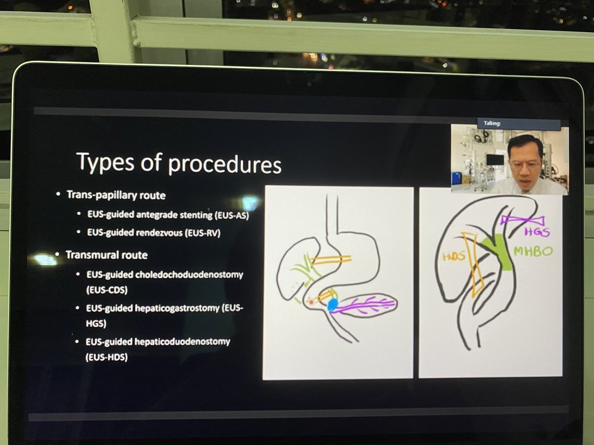 ChaiZhenHoo1's tweet photo. Listening to replay. Don’t want to miss out on such exciting learning opportunity #EUSBD #VIRTUALGUT2020 @MSGastroHepato https://t.co/M308htcICB
