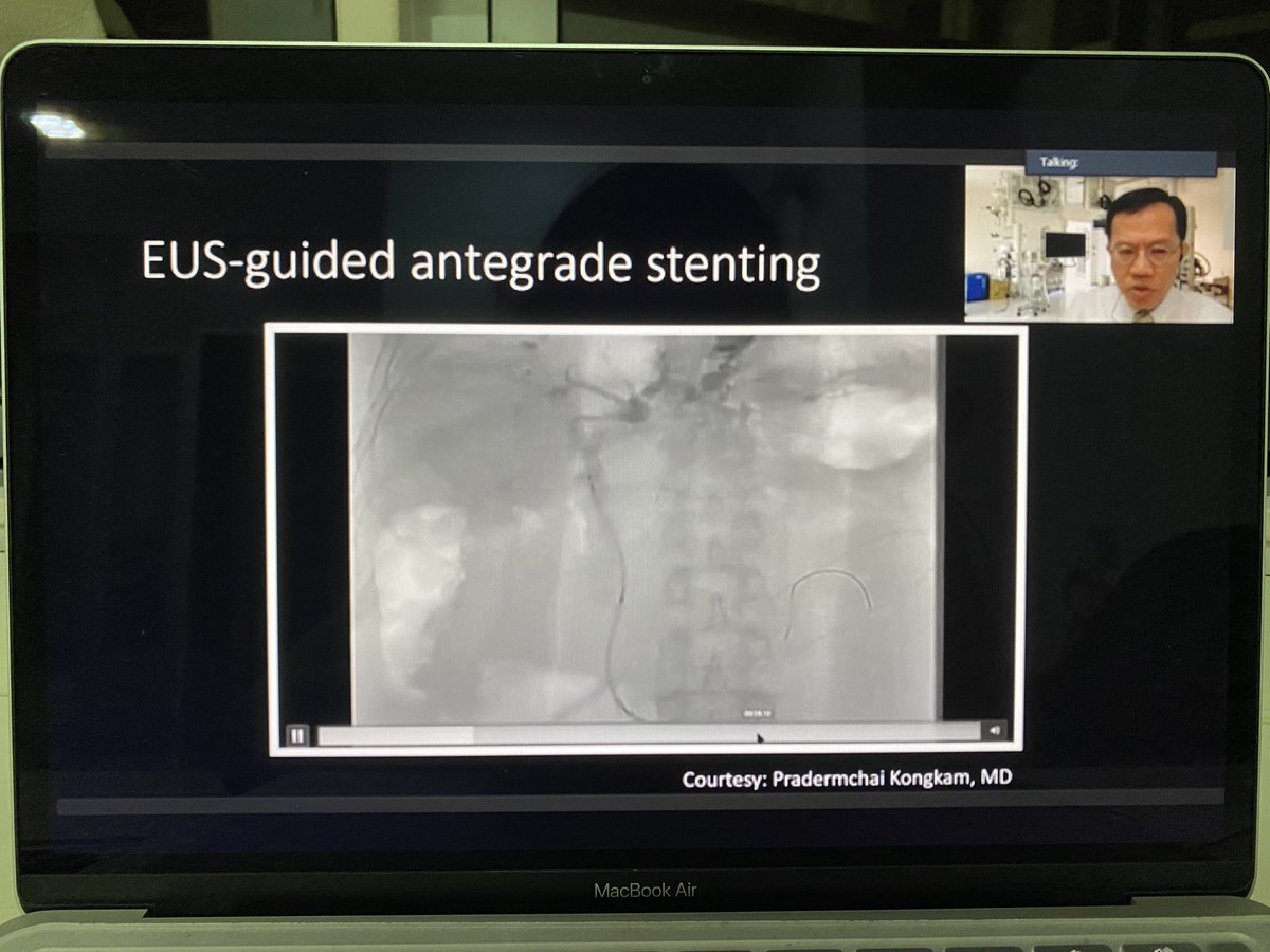 ChaiZhenHoo1's tweet photo. Listening to replay. Don’t want to miss out on such exciting learning opportunity #EUSBD #VIRTUALGUT2020 @MSGastroHepato https://t.co/M308htcICB