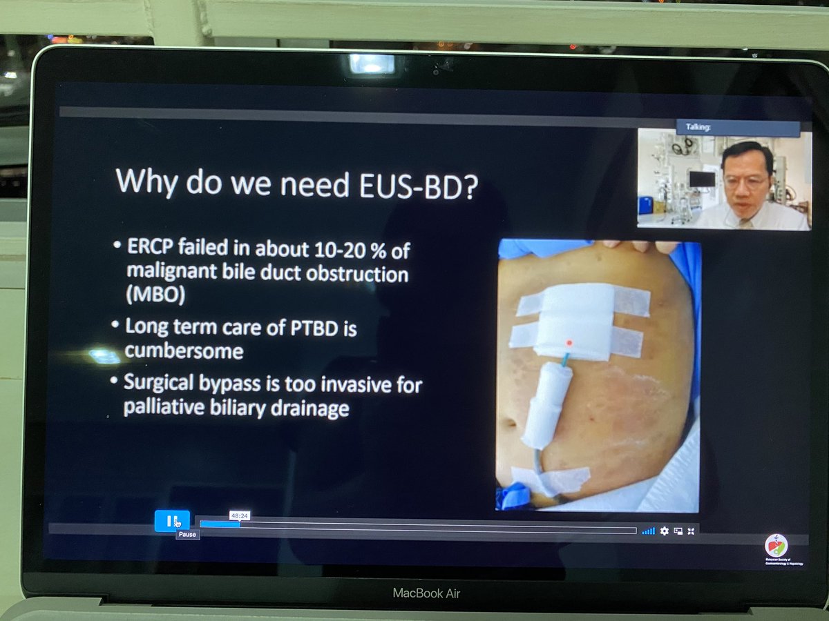 ChaiZhenHoo1's tweet photo. Listening to replay. Don’t want to miss out on such exciting learning opportunity #EUSBD #VIRTUALGUT2020 @MSGastroHepato https://t.co/M308htcICB