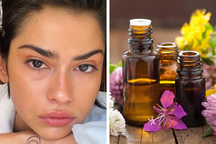 monvanityideal's tweet image. #CONSEIL L'excès de #sébum et de #kératine laissent parfois place à des #microkystes sur votre #visage qui provoquent eux-mêmes de l'#acné. Comment faire pour y remédier ? 😱

On répond à toutes vos questions dans notre article ! 👉 bit.ly/2IL7QKQ
