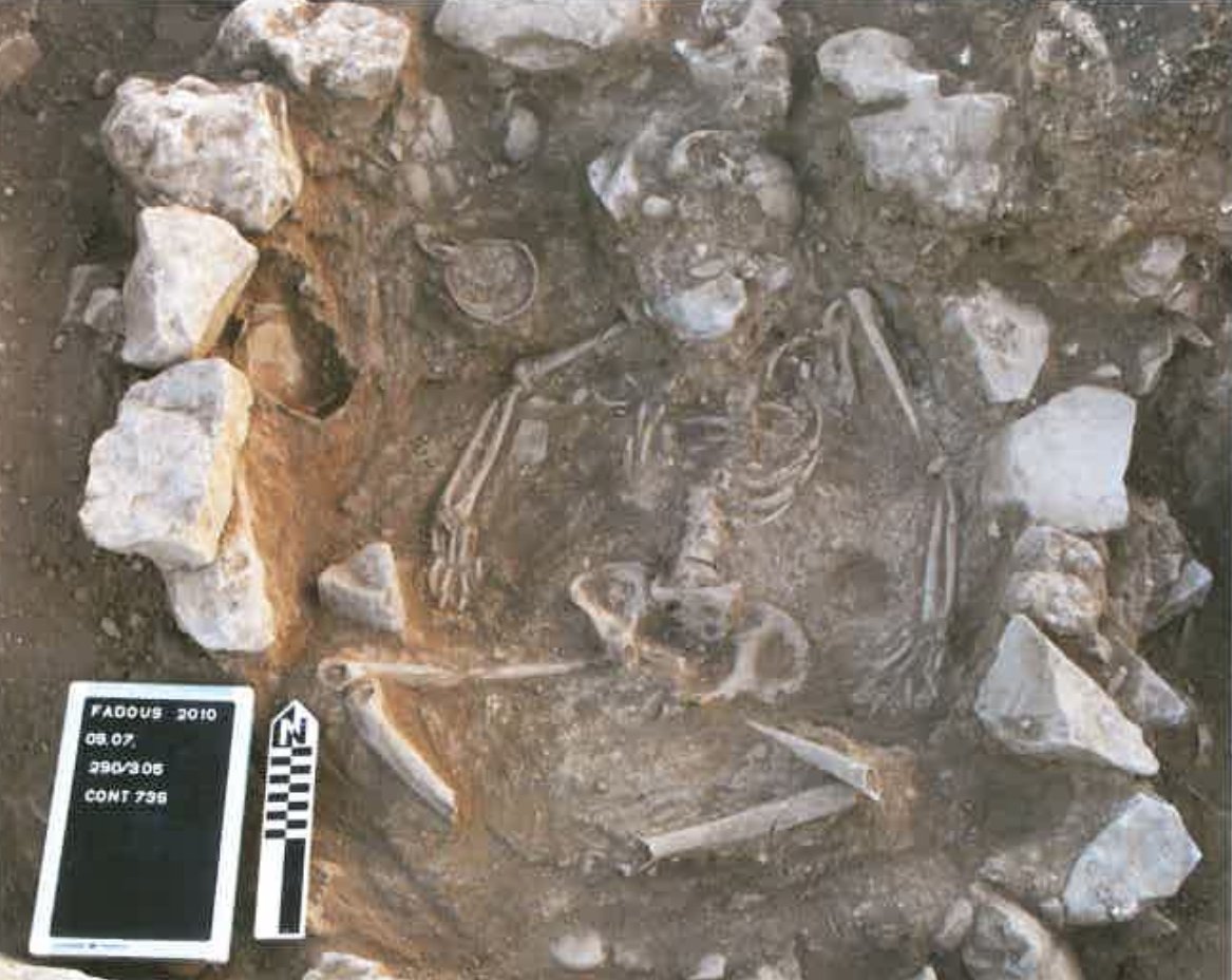 Find No.2, and of course a Bronze-Age burial. A middle-aged women buried lying on her back and surrounded by a circle of medium-sized stones. She had a bad fracture on her left femur (healed though), which definitely needed specific treatment (correction and stabilization).(4/5)