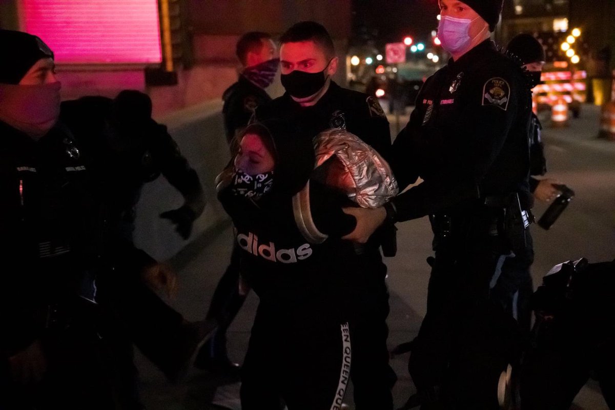 JazariKual's tweet photo. Posted with permission. 

Images of injuries this demonstrator has from @OmahaPolice officers #2411 &amp; #2399. 

She went to the ER a couple days later from severe pain &amp; was told her injuries were consistent to being in a bad car wreck. Including cervical spine strain &amp; whiplash. https://t.co/QFlqFUEGb1