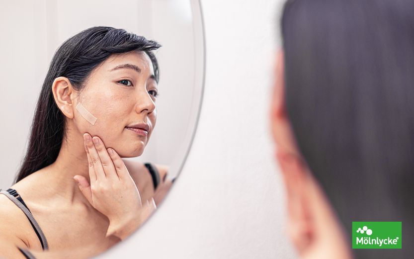 Mepiform_iberia's tweet photo. ¿Se tiene que tomar alguna precaución? #Mepiform debe usarse en heridas cerradas y a piel debe estar seca cuando se aplique el apósito. Si utiliza cremas, debe dejar que la crema sea absorbida y después aplicar Mepiform #cuidatupiel #reductordecicatrices https://t.co/rTkVbX94aw https://t.co/NajwH66ulF