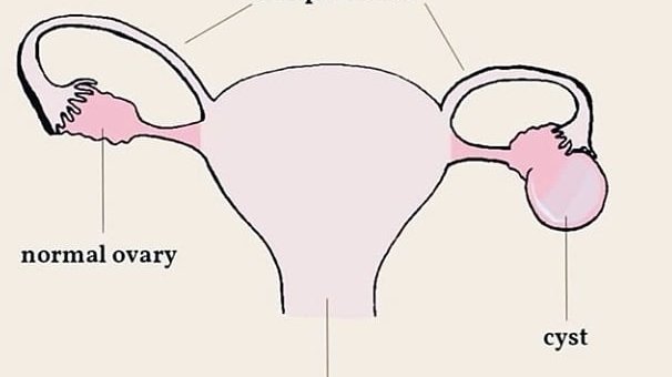 Mothersofangel's tweet image. Please support my GoFundMe campaign: gofundme.com/f/27dcu8zlc0?s… @gofundme