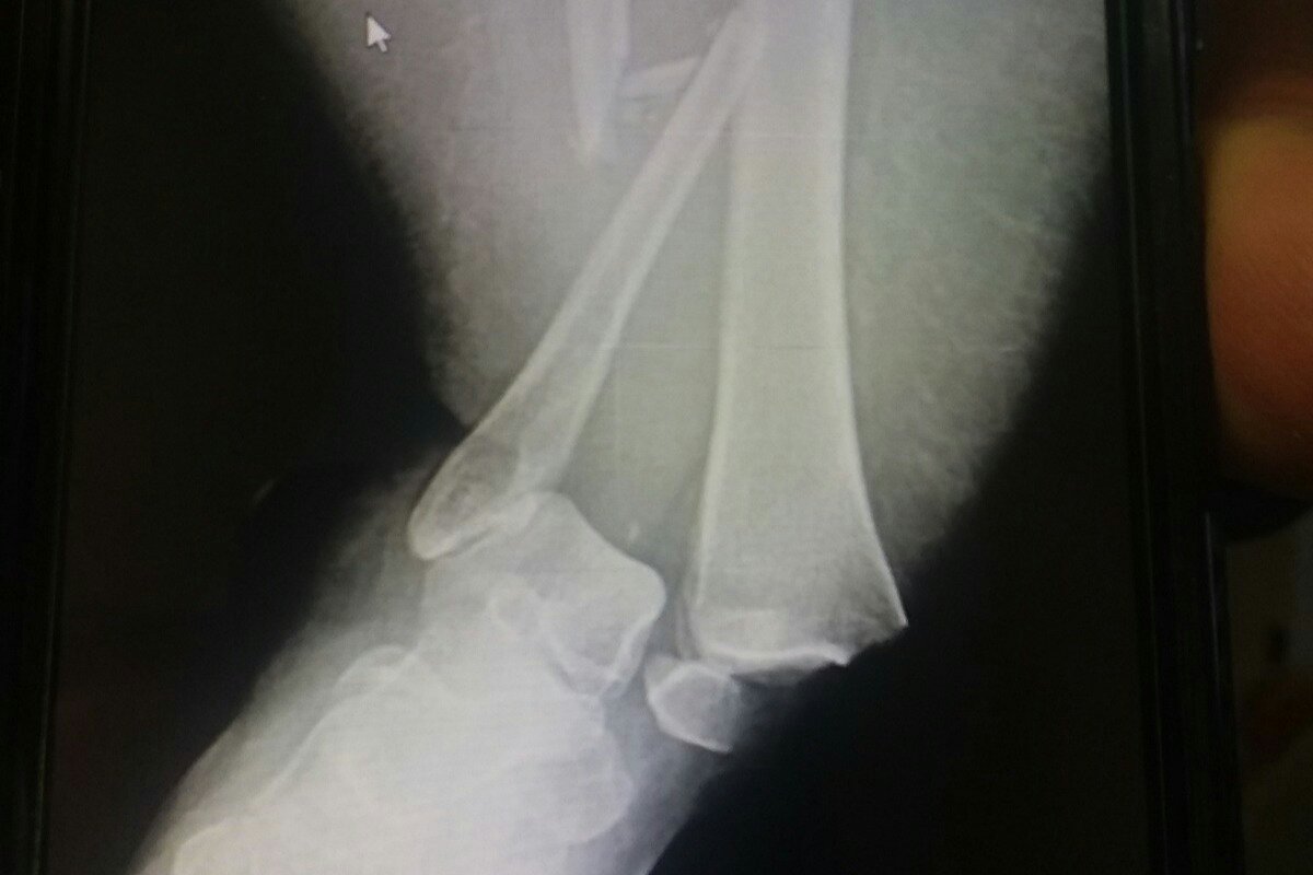 Please support my GoFundMe campaign: gofundme.com/f/help-crystal… <a href="/gofundme/">GoFundMe</a>