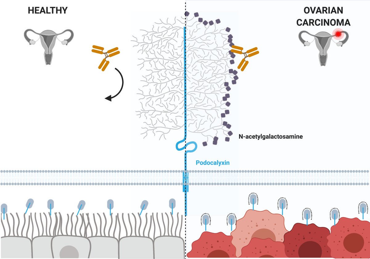 dcanals1's tweet photo. Excited to share our latest publication describing a promising #tumor-specific #antibody for #ovariancancer #therapy! https://t.co/NzLqXIbYdp 
@KMcNagnylab @mhughes_ubc @CBR_UBC @StemCellNetwork @UBCGradSchool @sitcancer https://t.co/5bxZOF8lGa