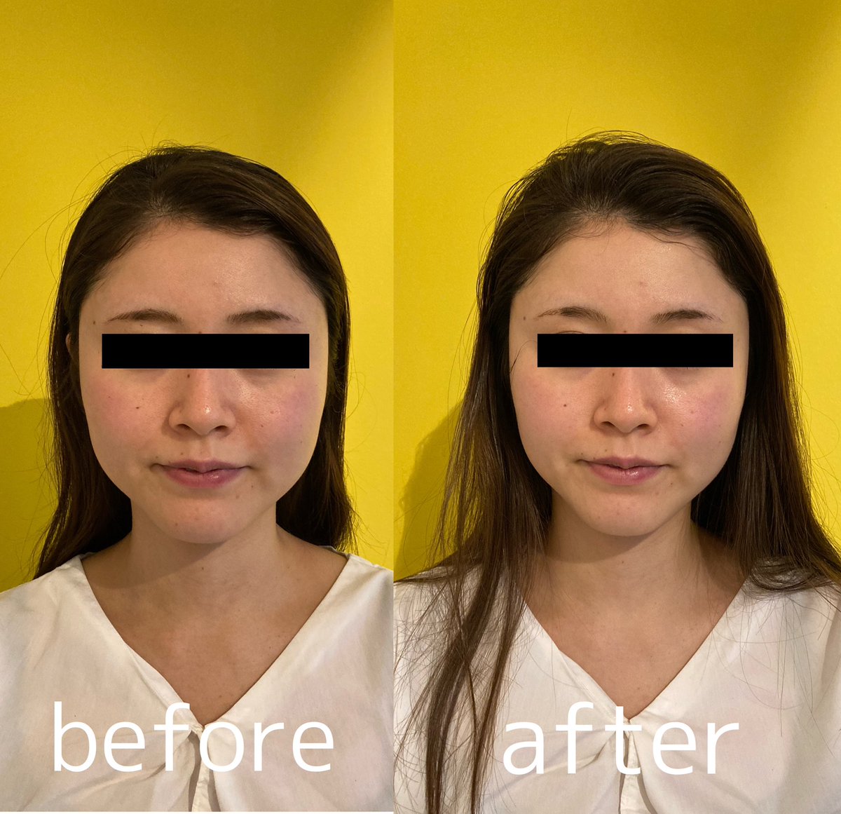 Hi Life Body Conditioning 小顔矯正1回でこれ 小顔矯正 小顔 美肌 スッキリ ファッション おしゃれ 代々木 南新宿 千駄ヶ谷 北参道 参宮橋