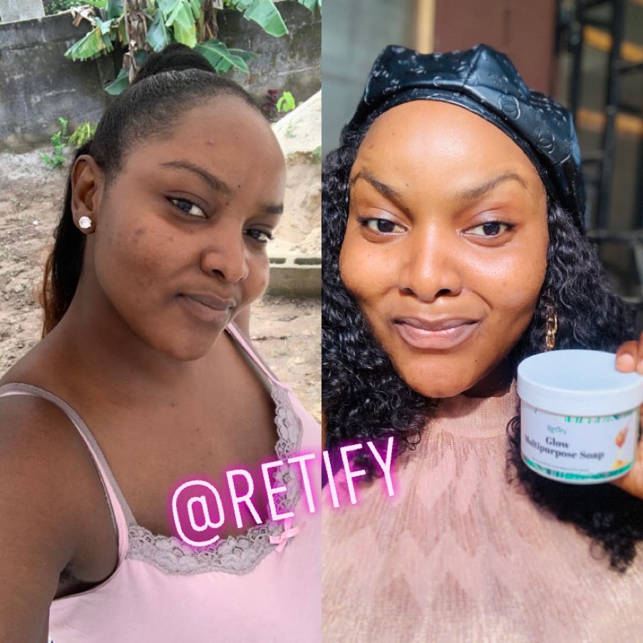 Retiola22's tweet photo. #NIGHTMARKETWITHDAMMYB
See my clients using our GLOW Multipurpose soap.  It’s almost Christmas o come get that champagne skin on a zobo budget just N4000 so many reviews on it https://t.co/8eoRWp3N9i