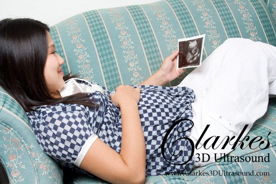 Clarkes3D's tweet photo. Keep a picture of your baby ultrasound with you as a reminder of the little perfect person to come. #pregnancytips https://t.co/hzOGPfaEjS