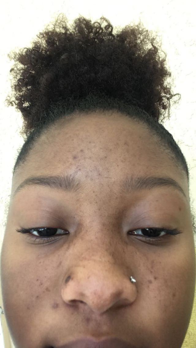 Ok my skincare routine THREAD: