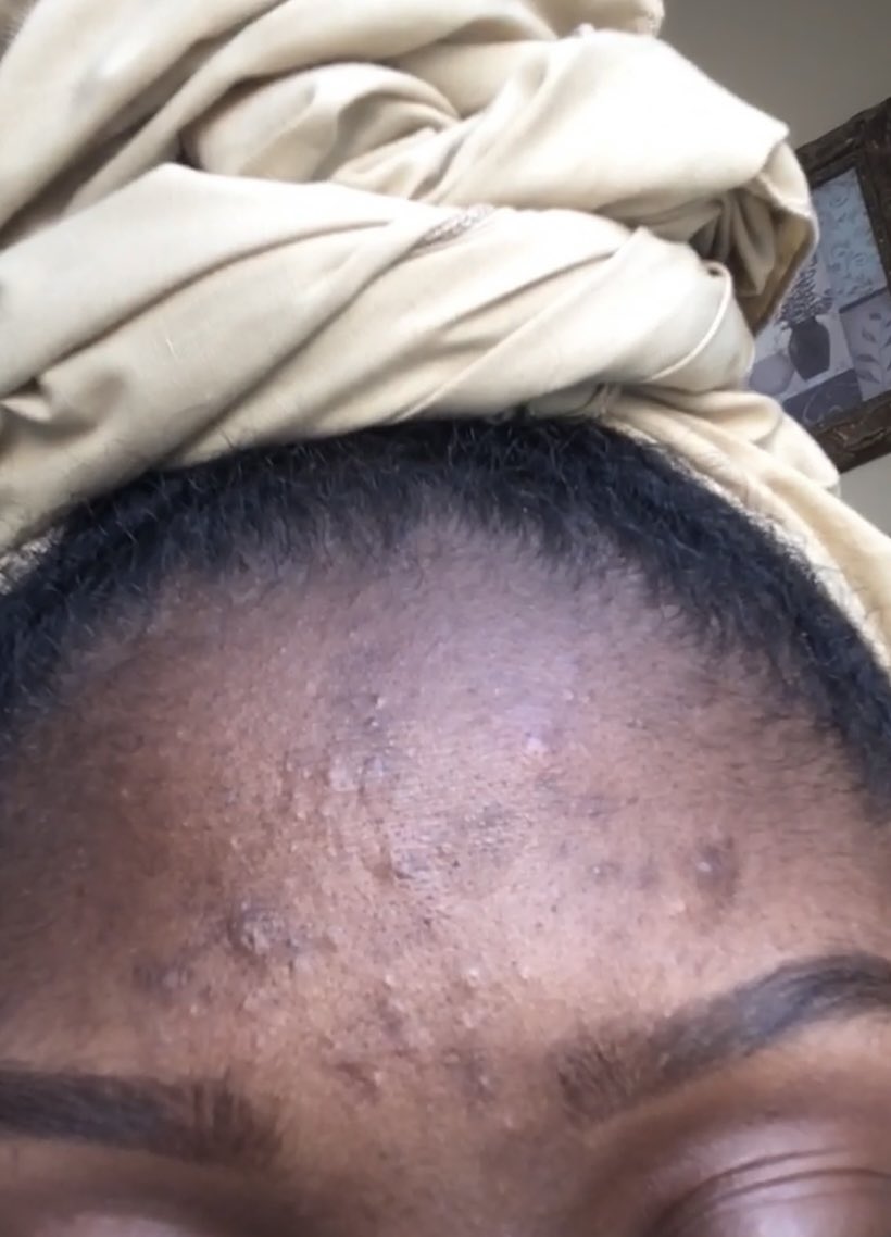 Ok my skincare routine THREAD: