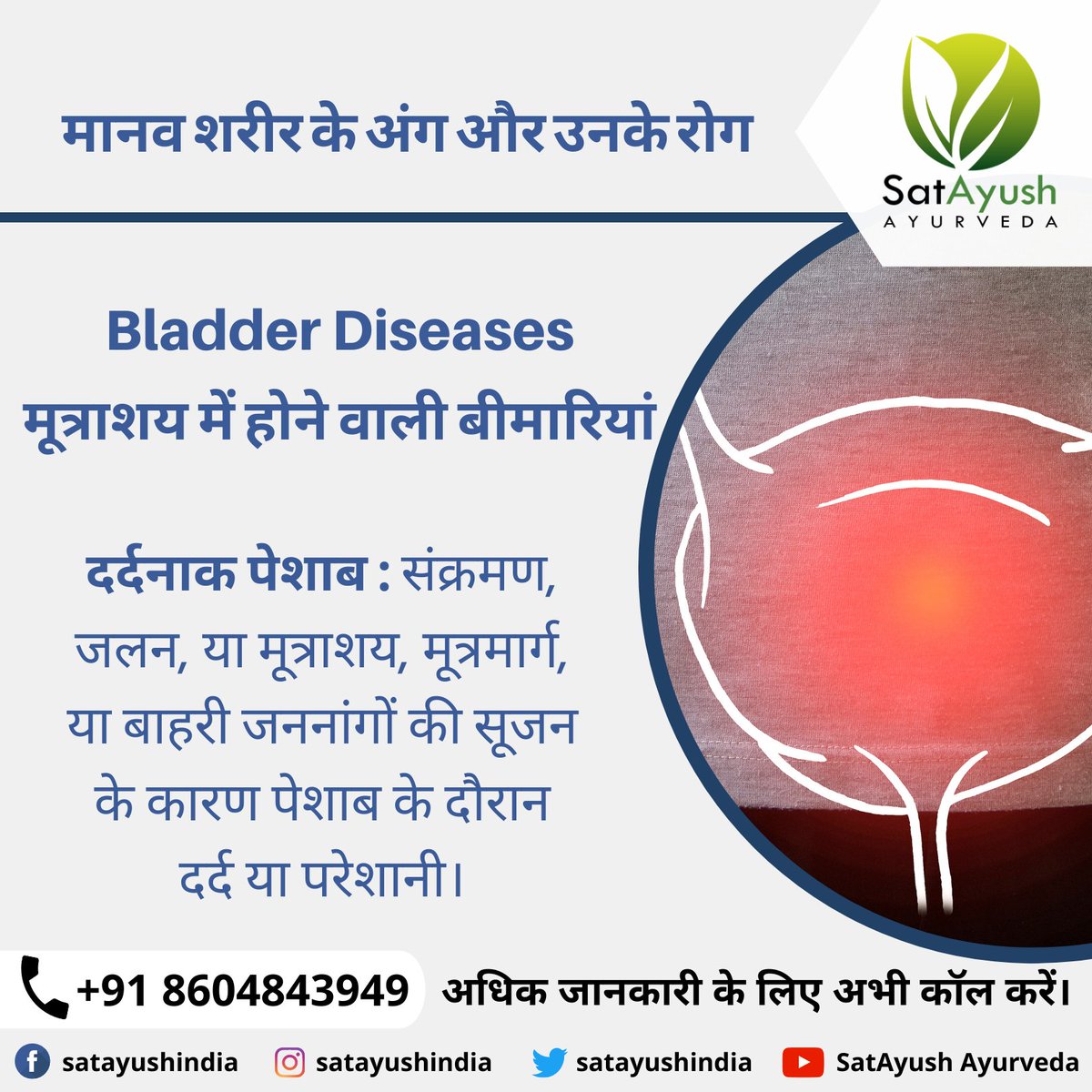 Parts of the #humanbody and their #diseases:- 
#Bladderdiseases -
#Dysuria (#painfulurination): Pain or discomfort during urination due to #infection, #irritation, or inflammation of the bladder, #urethra, or #externalgenitals.

#satayush #satayushayurveda #natural #ayurveda