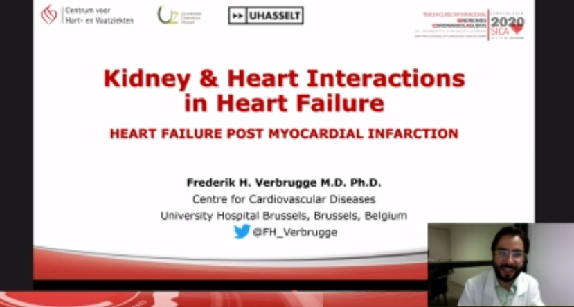 CpaolaParedes's tweet photo. Kindey and Heart interactions in HF #SICA2020 🇲🇽@FH_Verbrugge
👉There is an increased nephron loss in the life course of HF patients
👉⬇️Renal blood flow (RBF=MAP-CVP) is caused by low CO or high CVP.
👉⬇️RBF⬆️ Filtration fraction (FF=GFR/RBF) and ⬆️Intraglomerular pressure https://t.co/16kGsYYgrv