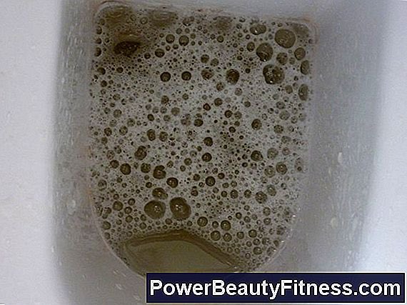 HELLO: If you pee and every time you finish, your urine looks like this picture, you may have a serious medical illness.Foamy urine especially if it is persistent and noticeable over time may mean you have a serious kidney problem.Let’s talk about this today...RT for others.