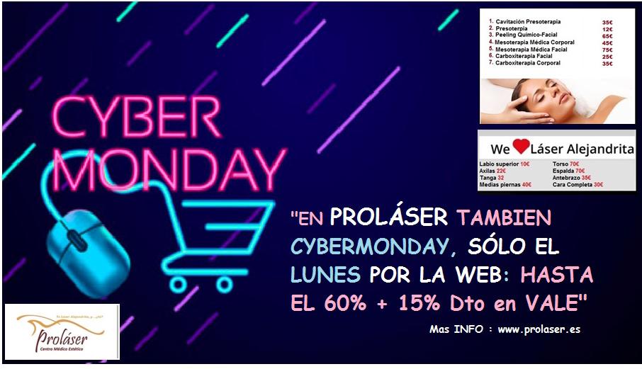 ProlaserCentro's tweet photo. ¡¡En PROLÁSER tambien CYBERMONDAY!! Sólo Lunes por la WEB : Hasta el 60%+15% Vale" https://t.co/chyUHvRYpT https://t.co/j4AsrjMshT
