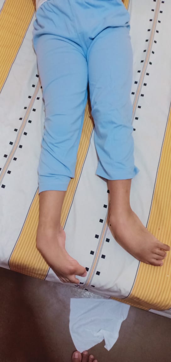 Chintya___99's tweet photo. Awalnya sakit dari usia 2th mengalami gangguan saraf tulang belakang lalu mempengaruhi kaki jadi bengkok dan bicara ngk bisa, usianya menginjak 15th sekarang.

Nama Muhammad  Fahri
Jl.jembatan gantung RT 06/08 Kel kedaungkaliangke
Kec.cengkareng Jakarta barat https://t.co/RfQUYmrlRx