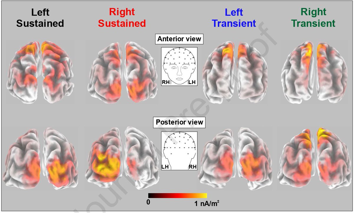Di Russo Francesco, Berchicci Marika, Bianco Valentina, Perri Rinaldo Livio, Pitzalis Sabrina, Mussini E: Modulation of anticipatory visuospatial attention in sustained and transient tasks. 28 November 2020 In Press
https://t.co/wlb87r7APJ https://t.co/qzB3ezd9cH