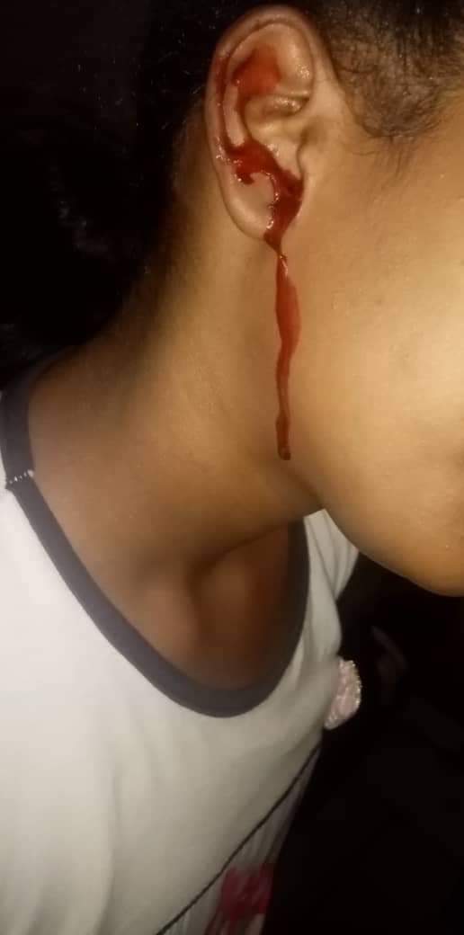 aya_osama98's tweet photo. 🚫اتمنى كل زول يشوف التويتة دي يعمل ريتويت حتى قبل يقراها
اسفة لحساسية الصور
Waad is 12 years old who just wants to stop bleeding. She has a rare inherited bleeding disorder called Glanzmans Thrombasthenia . Waad spends most of her childhood in hospitals.
#thread https://t.co/ctpis6b7OM