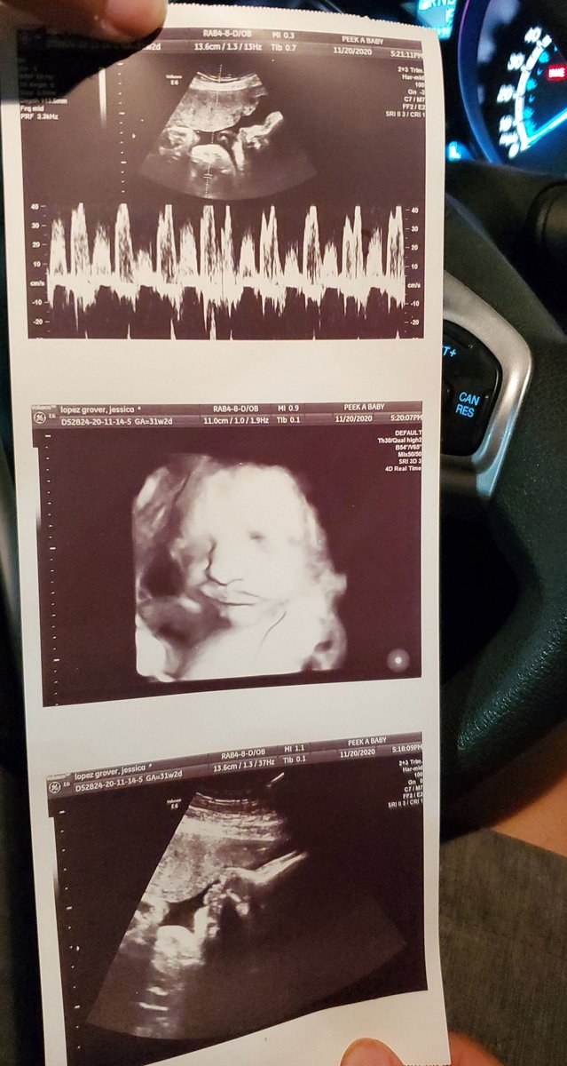 JessicaLopezGr3's tweet photo. @JeffreeStar My baby boy is due in 7 weeks.  Anything would help to finish getting stuff we need for him.  
Cash app $jess9798 https://t.co/AOuAle88Ow
