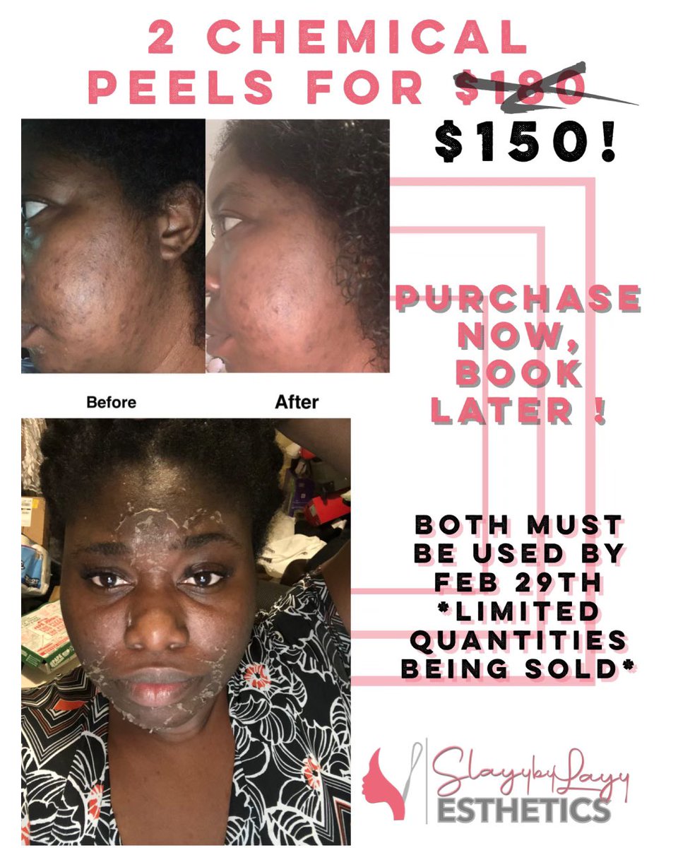 #SmallBusinessSaturdays #atlantaesthetician #atlantachemicalpeels #atlantafacials linktr.ee/slayybylayyest…