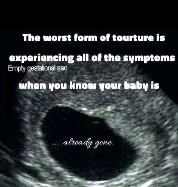 Mothersofangel's tweet image. #PregnantWoman #preggers #pregnancy #pregnant #miscarriage #childloss