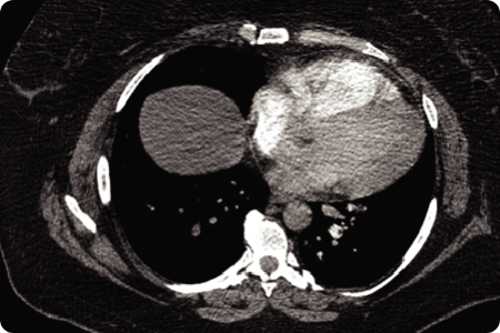 cekahn's tweet photo. Kudos to all of the winners of this year's @RSNA @thoracicrad #AI Pulmonary Embolism Detection Challenge! https://t.co/A04qNQZ4dH #RSNA20 #RSPECT #DeepLearning @kaggle #PulmonaryEmbolism https://t.co/HGfDQlLrYj