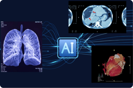 cekahn's tweet photo. Want a peek into the near future? This multi-vendor #interoperability demonstration shows how tools based on #ArtificialIntelligence are being integrated into the diagnostic radiology workflow https://t.co/2cQ0RNoIFE #RSNA20 #AI  @RSNA https://t.co/LANDJ9haw1