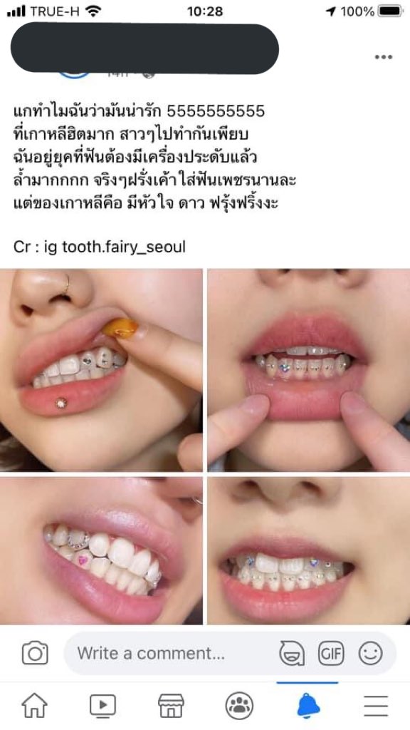 nanajt0902's tweet photo. **อย่าหาทำ** หมอฟันเห็นแล้วจะเป็นลม การติดอะไรพวกนี้ส่วนใหญ่ใช้กาวตราช้างติด ซึ่งมันอันตรายมากนะ หรือบางคนบอกว่ากรอฟันให้เป็นรูแล้วใส่เข้าไป ยิ่งหนักอีก รูตรงนั้นเป็นที่สะสมของแบคทีเรีย ฟันผุขึ้นมาแลกกับเพชรพลอยพวกนี้ไม่คุ้มเลย ปกติก็ทำความสะอาดกันไม่ค่อยสะอาดอยู่แล้ว ฟันผุแน่ https://t.co/Qy3ag0BMz0