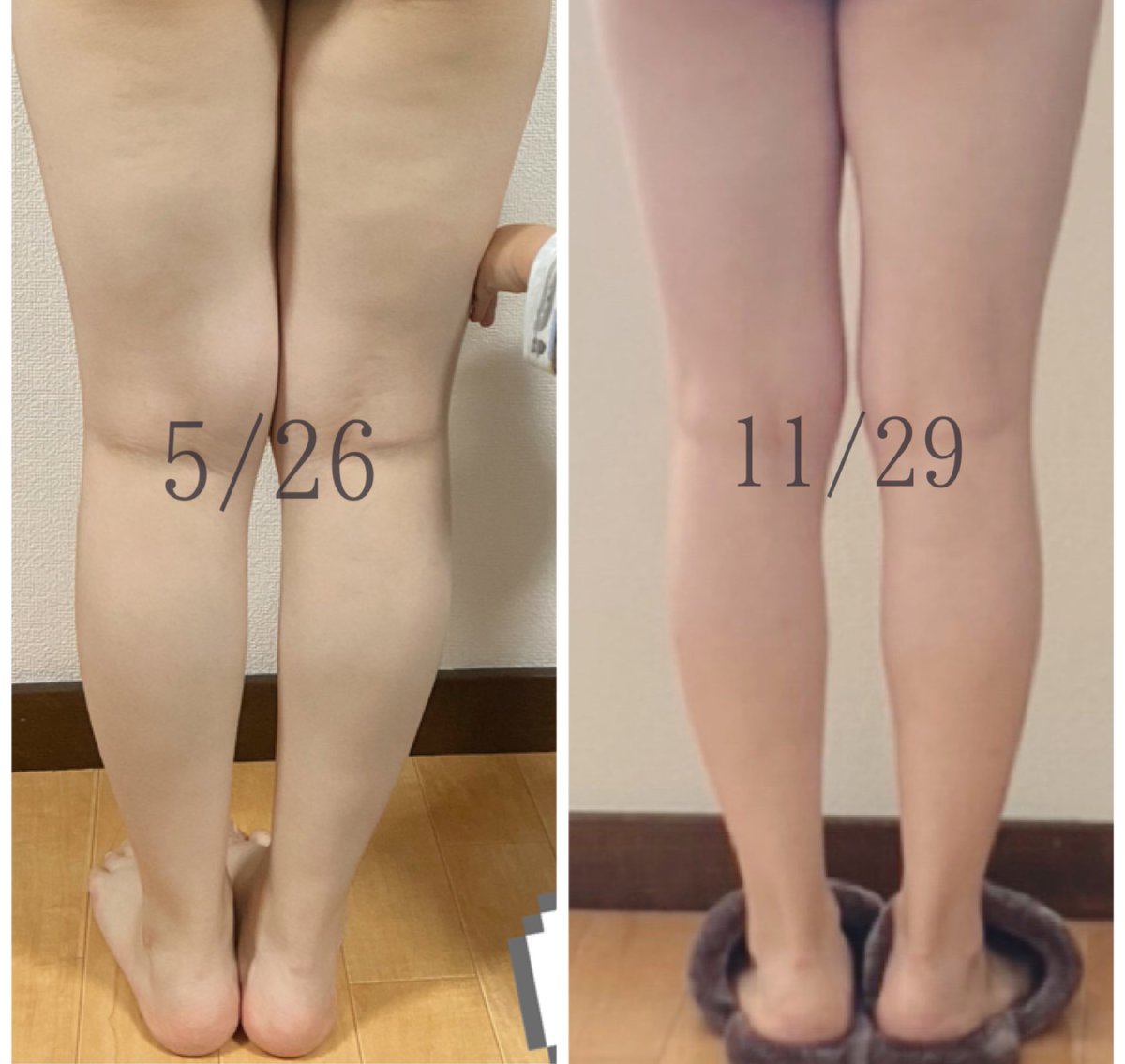 ｅ Oxo Mn すごいーーーー お腹めっちゃ細いし 脚もめっちゃ綺麗になってる 私お尻 太ももが昔から逞しくて脚やせが永遠のテーマだからほんと尊敬 最近サボり気味だったけどまた始める Twitter