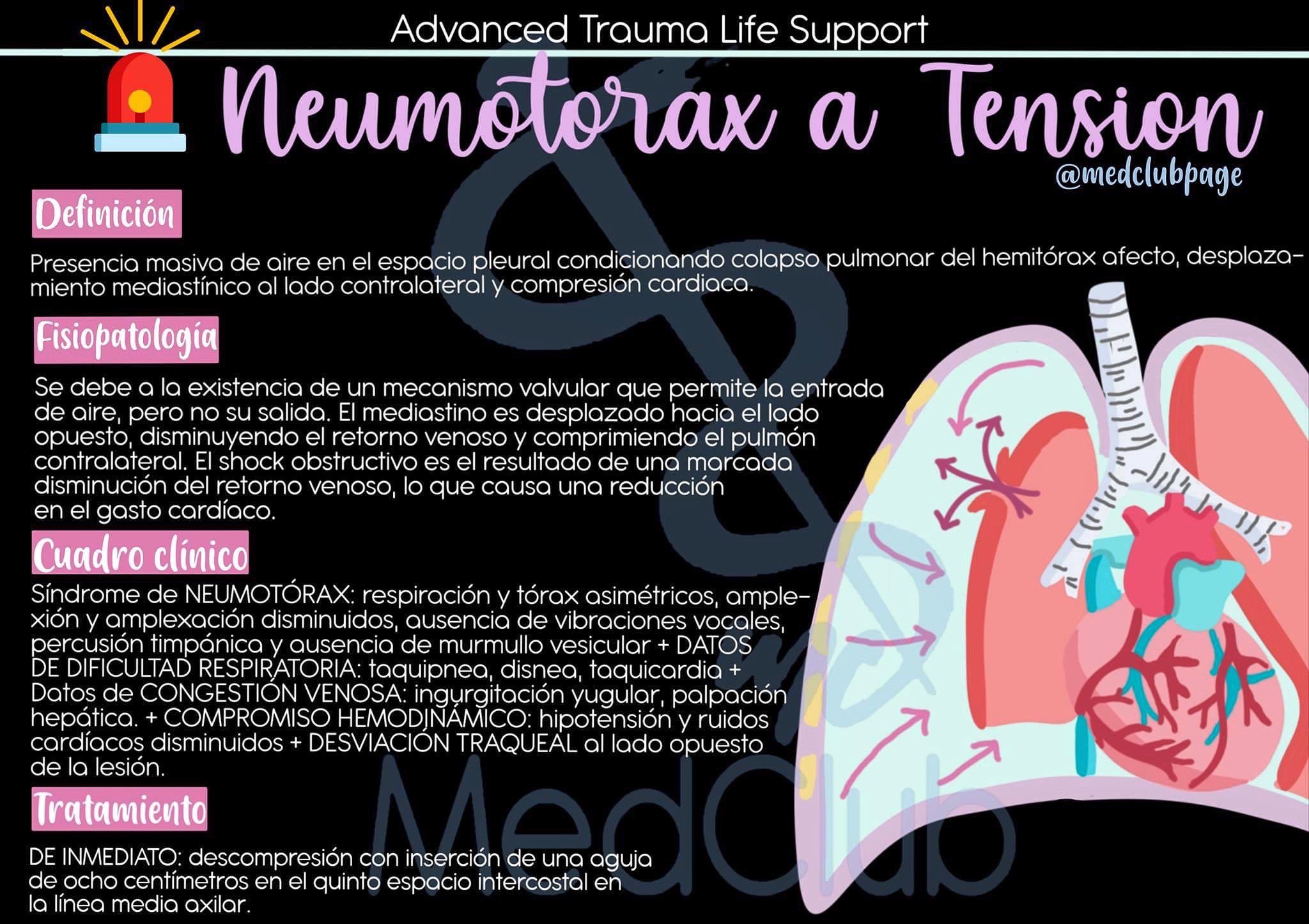 MedClub on Twitter: "#Urgencias #ATLS #ENARM2021 📌Fichas rápidas de estudio: ATLS➡️Neumotórax a tensión🎈 https://t.co/kmVLGRaTQY" / Twitter