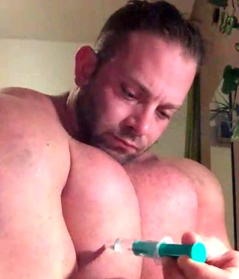 SyntholG's tweet photo. @BerlinLuke @Big_Mscl_lover @roidedlover @siliconemeup Could be Synthol 🤔 https://t.co/czgcv0KhGB