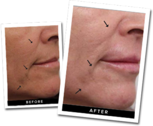 damowanggg's tweet photo. #OxyGeneo 3 in 1 machine
#Plump #hydrate
#skinvolume #renew#wrinkleremoval
#Firmskin #tighten #pores #pigmentation
#Safe for any skin type
Certificate: CE approved
☎️Whatsapp:0086 15503022871 https://t.co/nUH4r8IvRG
