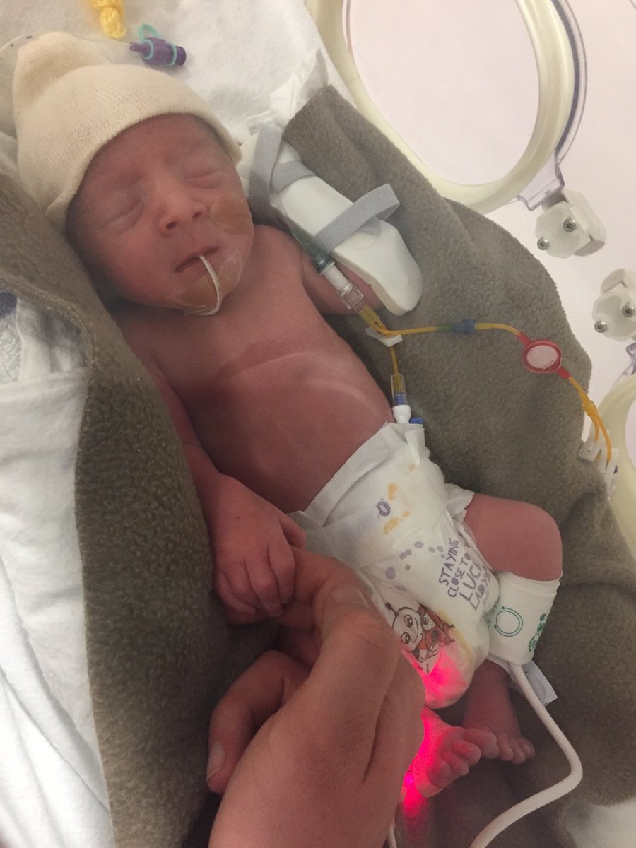 Christmas3Count's tweet image. On #WorldPrematurityDay we wanted to say yet another HUGE thank you to @WRHNeonatal @WorcsAcuteNHS for looking after our special elf when he decided to come into the world two months early. We cannot ever thank you enough for what you did. 🙏💜