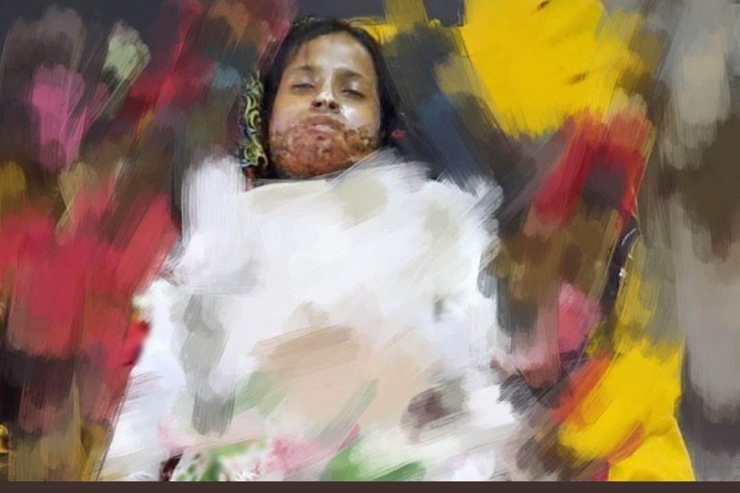 हम उस देश के वासी हैं,
जिस देश में बेटी जलती है।।
😒😰😭
#गुलनाज_को_न्याय_दो