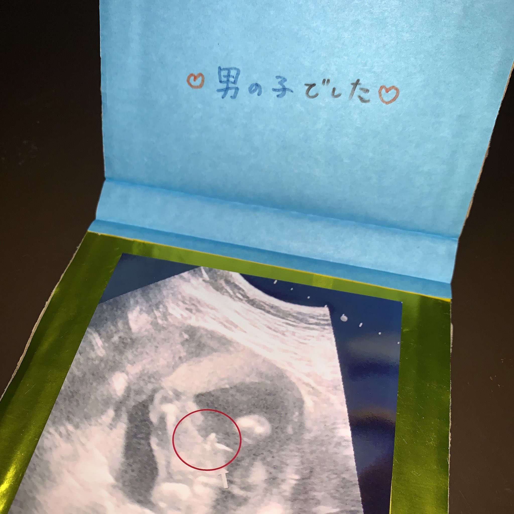 Kaede 7m さっそくサプライズ 色々迷っておにぎりにした 男の子 昆布 女の子 イカ明太 結果は昆布で 男の子 私の可愛い王子様 ジェンダーリビール ジェンダーリビールおにぎり 性別発表 Kaede 7m さっそくサプライズ 色々迷っておにぎりにした 男の子 昆布 女の子 イカ明太 結果は昆布で 男の子 私の可愛い王子様 ジェンダーリビール ジェンダーリビールおにぎり 性別発表