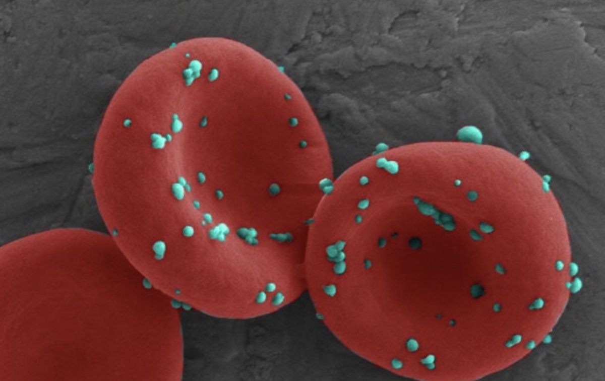 The systemic administration of erythrocytes with chemokine-encapsulating nanoparticles non-covalently anchored to their surface results in local and systemic tumour suppression in mouse models of lung metastasis.

rdcu.be/caTWt