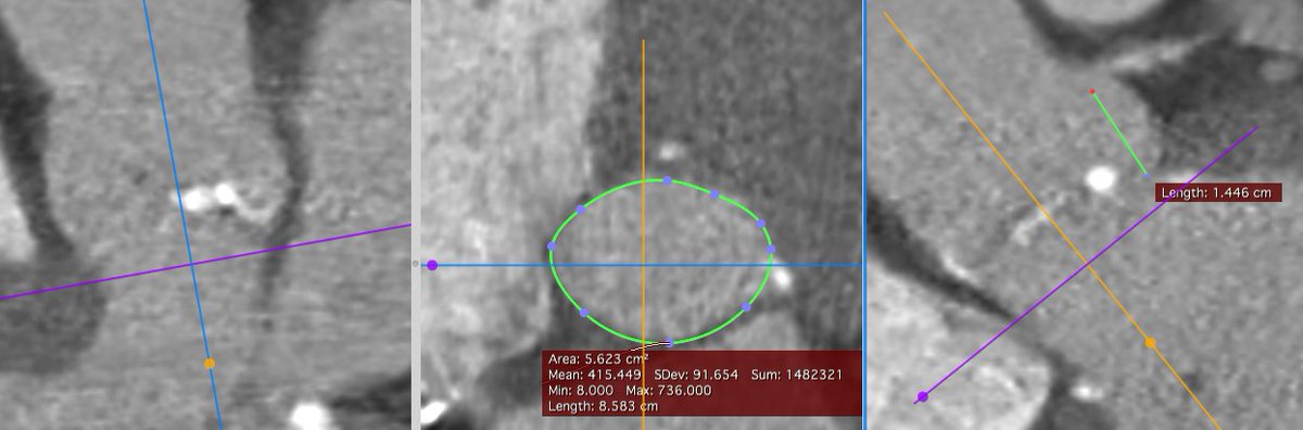 pierredeharo tweet media